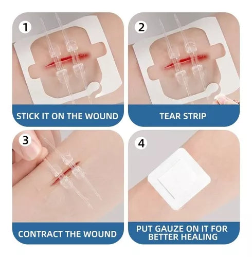 CINTA PARA CERRAR HERIDAS X2